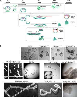 Understanding bovine embryo elongation: a transcriptomic study of trophoblastic vesicles